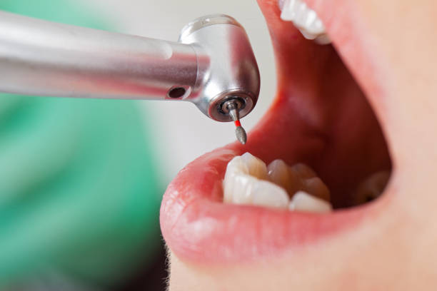 Best Pediatric Emergency Dentist in Andover, KS